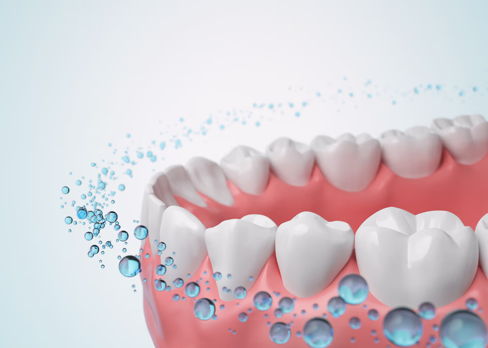 Fluoride Treatments