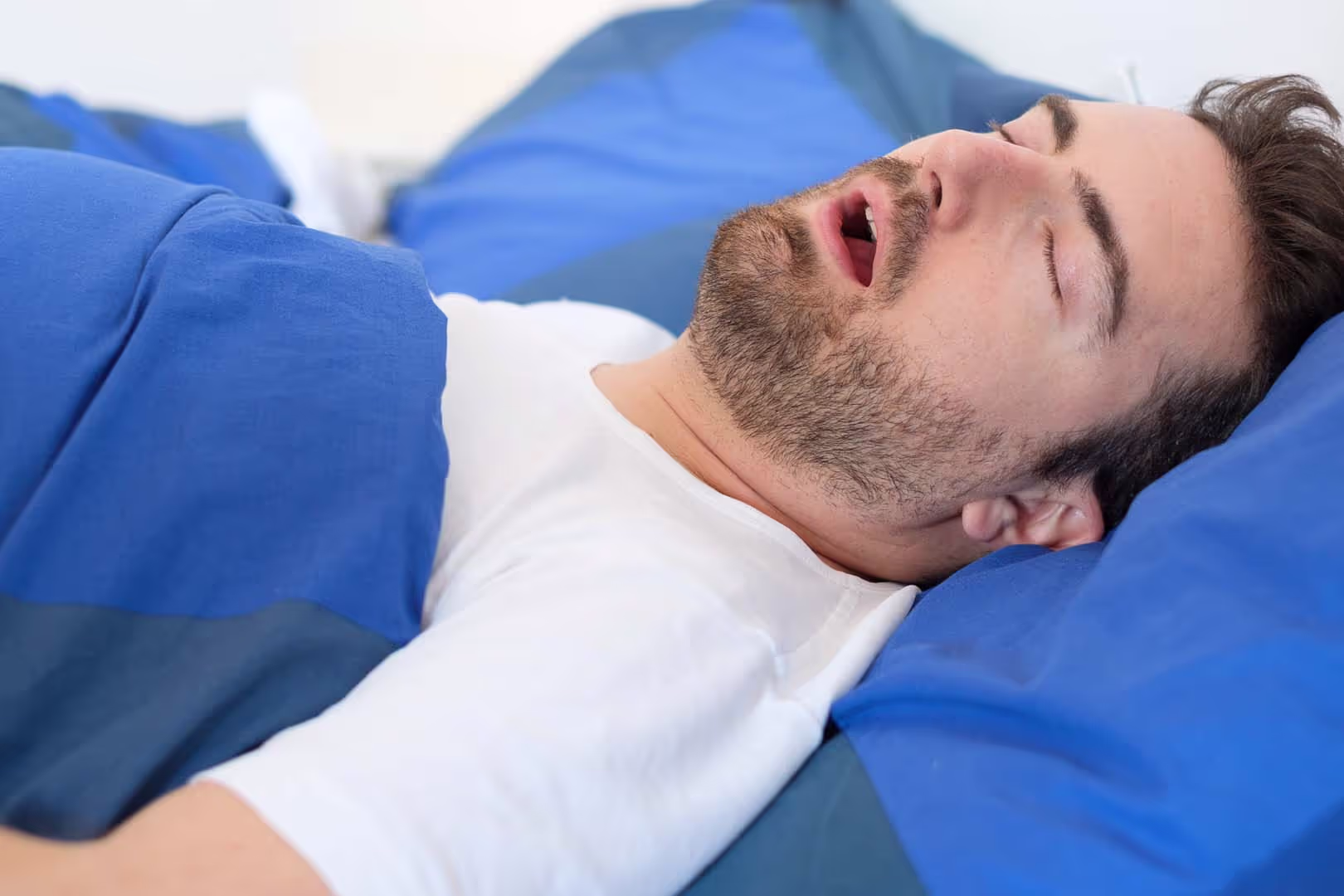 Sleep Apnea Treatments
